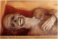 Mumie von St. Thomas am Blasenstein